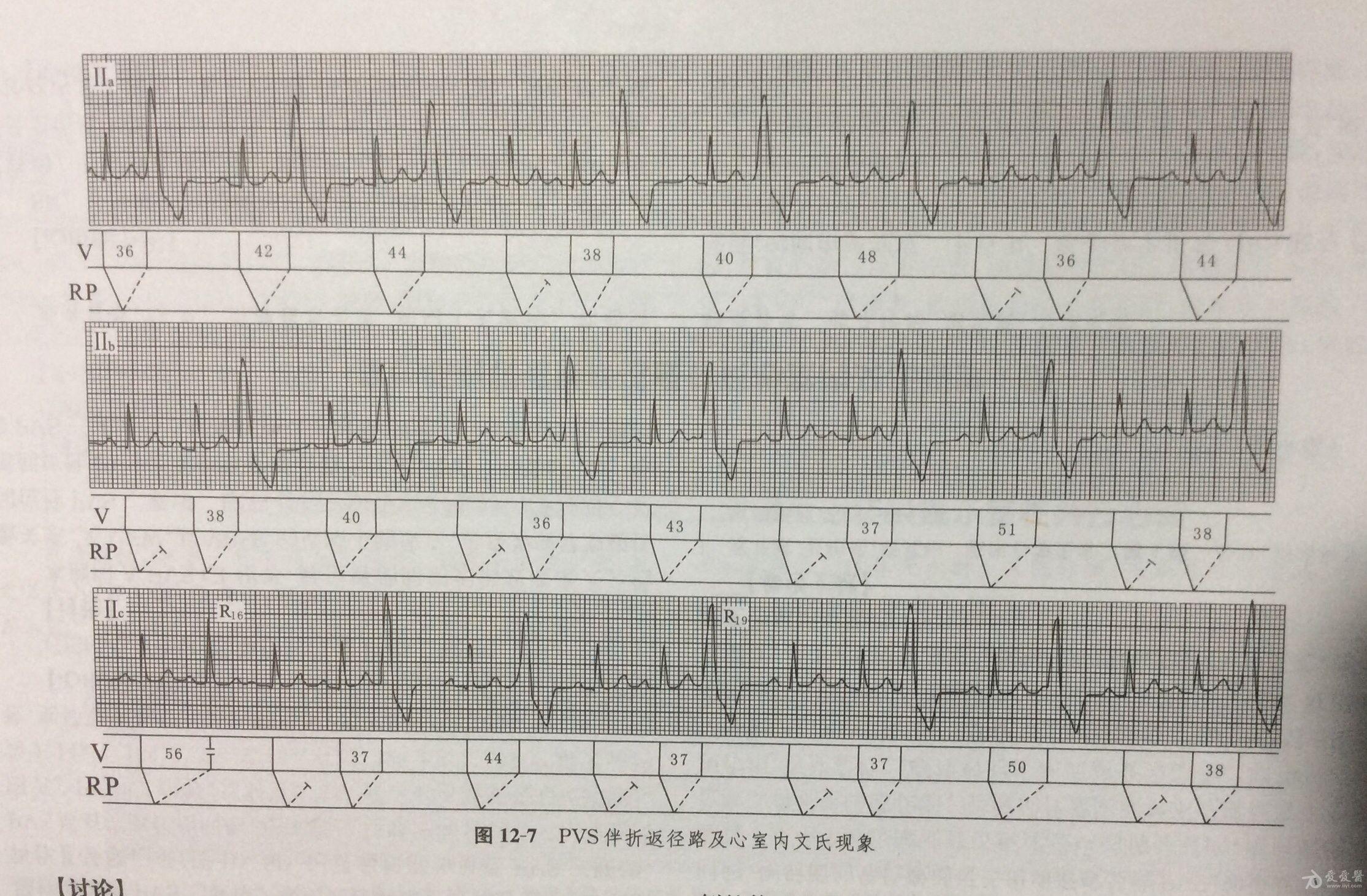 联导绝转期有状，揭秘群发信息中的SEO奥秘，揭秘群发信息中的SEO奥秘，联导绝转期有状状态解析