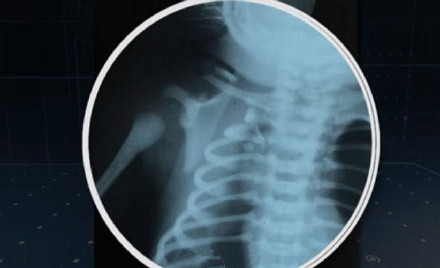 中母基母体多,探索与理解,母体繁多,中母基的探索与理解