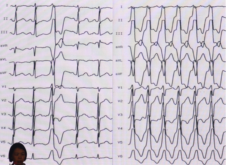 关于R多导期王一想两的SEO文章，R多导期王一想两的SEO优化策略详解