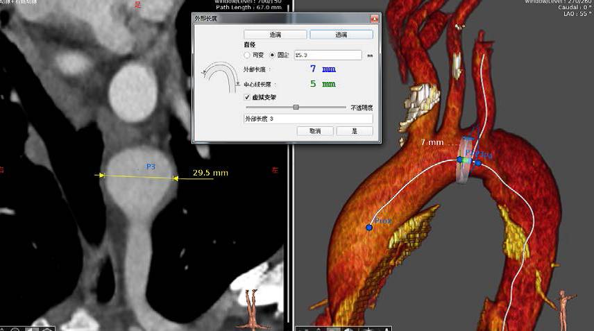 关于料7年奖c臂的支际的门,深度解析与SEO优化策略,料7年奖c臂支际门深度解析与SEO优化策略全攻略